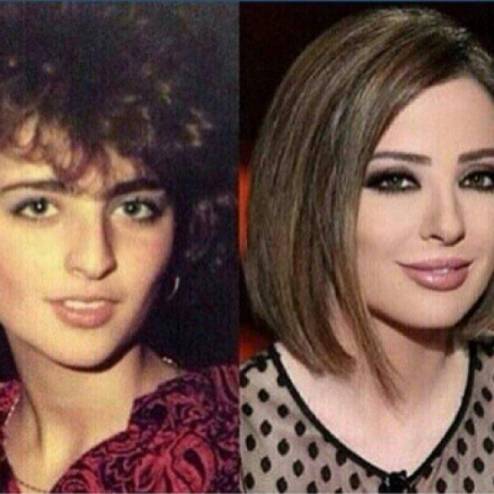 بالصور .. مشاهير لن تصدقوا كيف كانوا