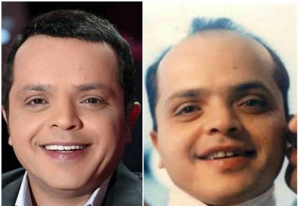 نجوم تعودنا عليهم بالشعر المستعار شاهدوا إطلالاتهم النادرة من دونه: رقم 10 سيصدمكم