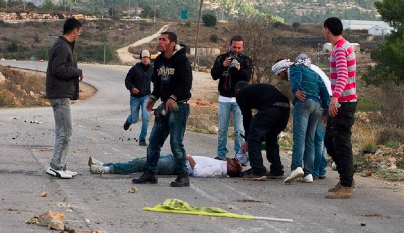 إصابة شاب دهسه مستوطن بالقدس