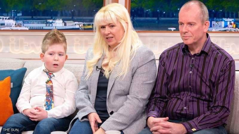 صورة .. حير "الاطباء" الحالة "المعجزة" طفل "بلا دماغ"