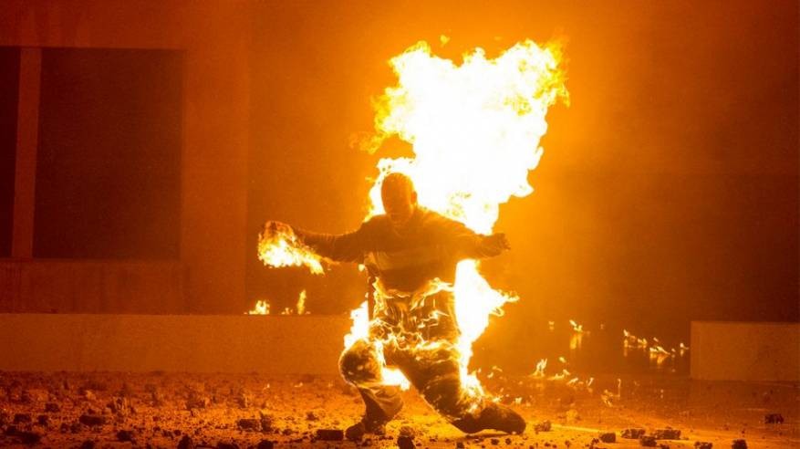 والسبب لون بشرته