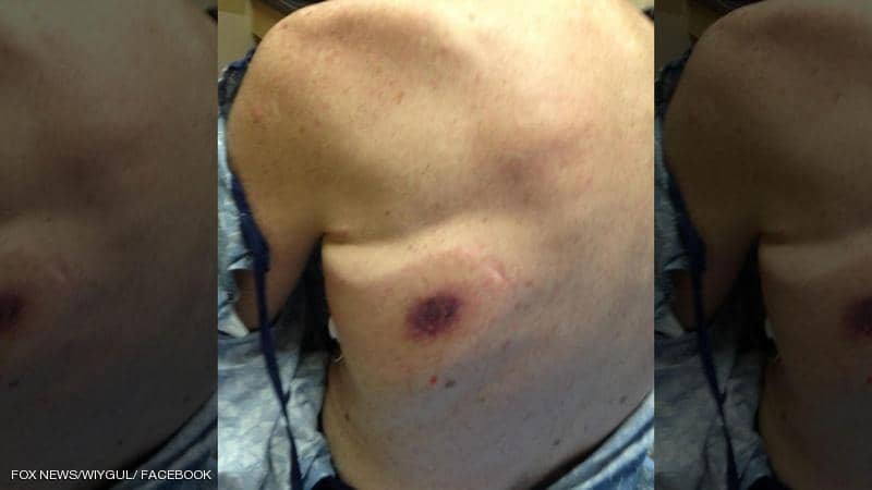 "آكلة اللحم" تقتل رجلا بعد 48 ساعة من نزوله إلى الماء