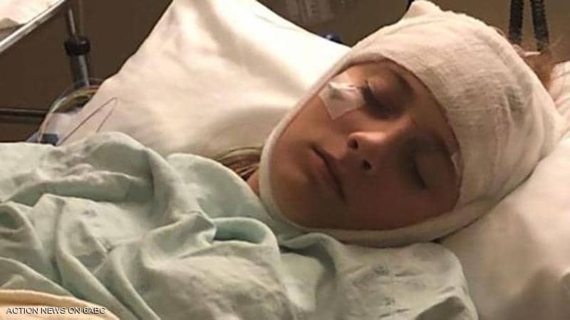 حالة طبية "غريبة".. ذاكرة فتاة تعيد ضبط نفسها كل ساعتين