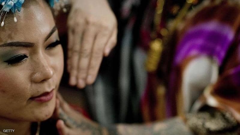 وفاة بريطانية بعد خضوعها للعلاج بـ"الصفع"