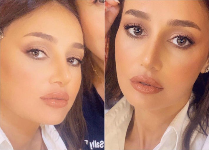 بالفيديو و الصور: "حلا شيحة" تنفي إجراء عملية تكبير للشفاه