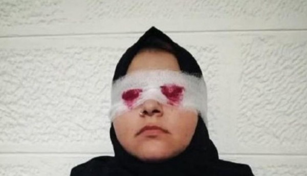 الأردن: تفاصيل مروّعة جديدة عن "مقتلع عيني" زوجته