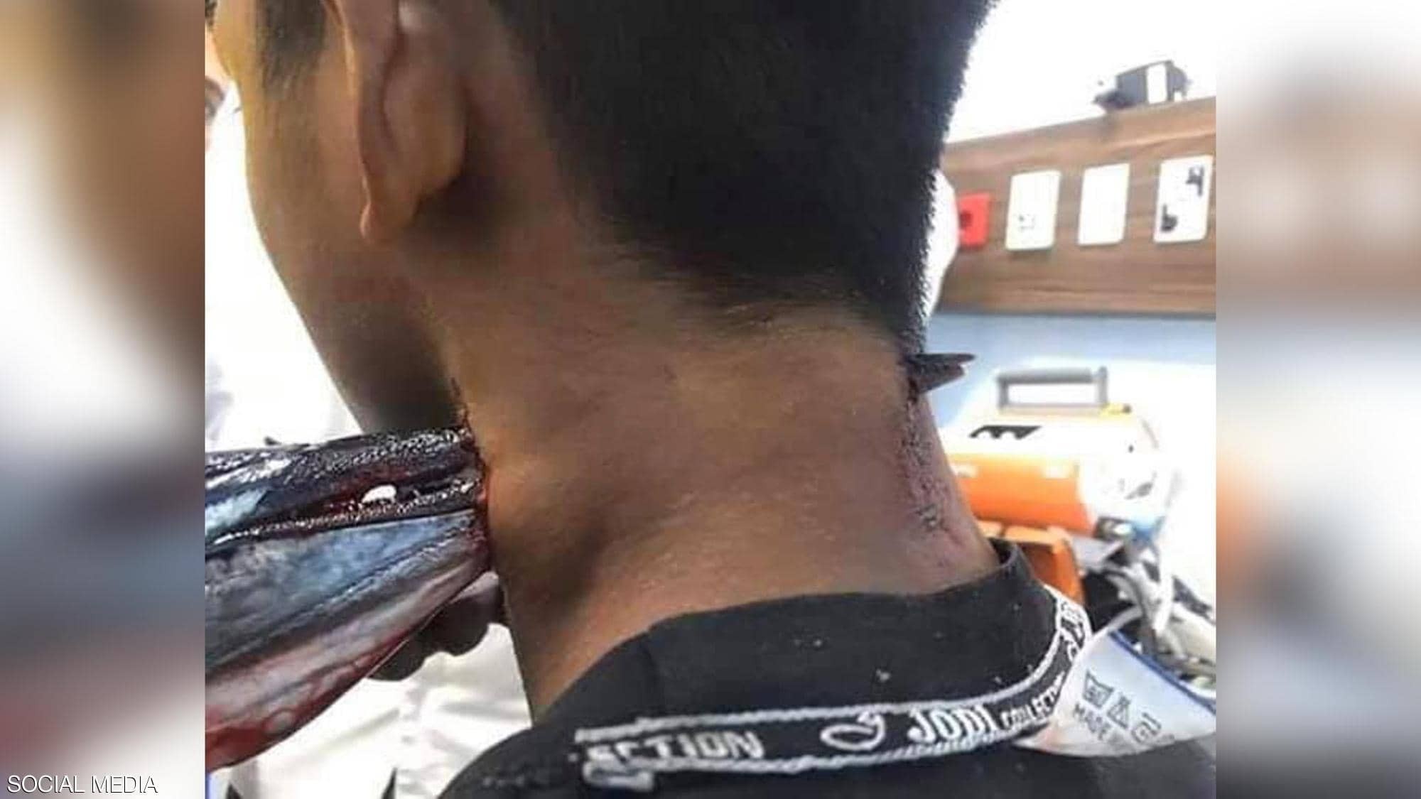 شاهدوا: سمكة "الإبرة" قفزت من "المياه" واخترقت رقبة فتى