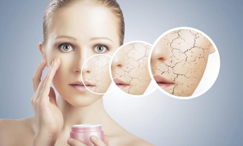 6 خطوات لمعالجة مشكلة جفاف البشرة في الشتاء