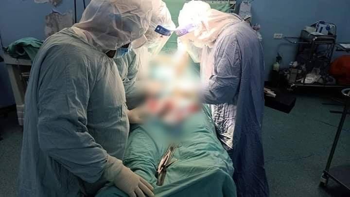 أطباء بغزة ينجحون في استئصال جلطة حادة من قدم مريض مصاب بـ"كورونا"