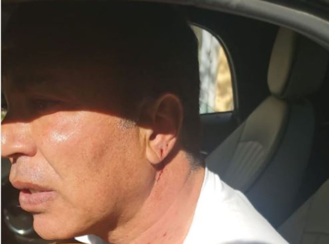 شاهد: الاعتداء على ايمن يونس يشعل مواقع التواصل في مصر