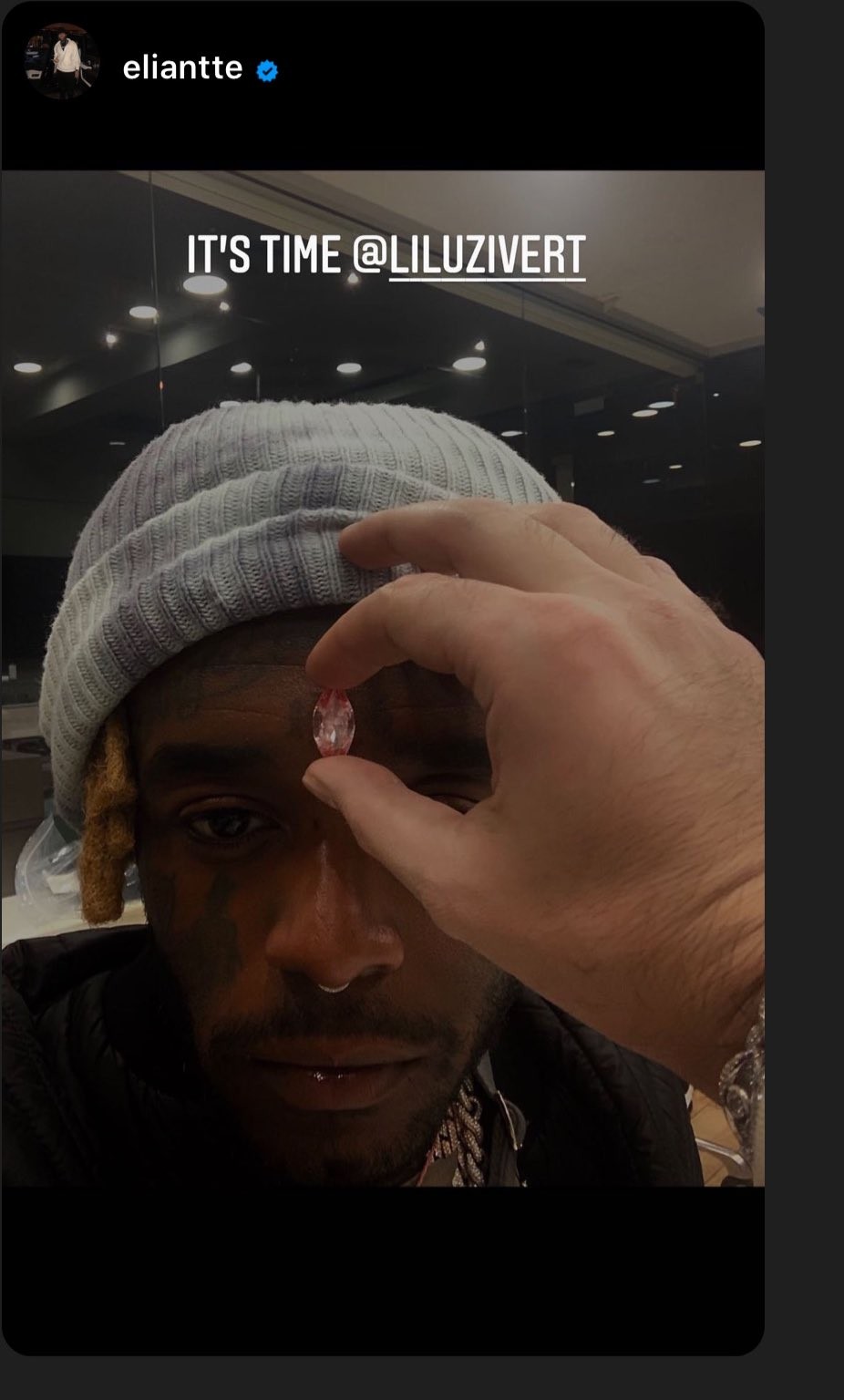 شاهدوا: مغنى راب أمريكي يخطط لزراعة ألماسة في وجهه بقيمة 24 مليون دولار