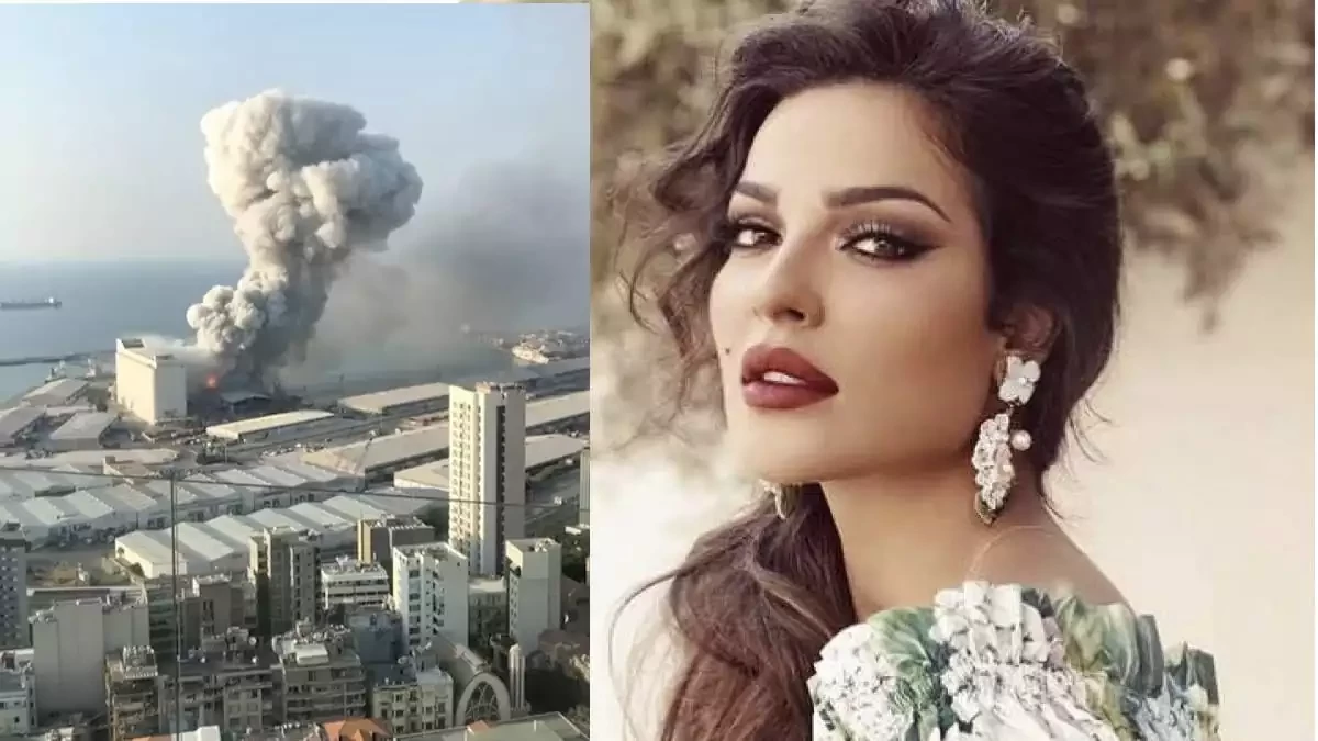 نادين نسيب نجيم ترد على اتهامها بادعاء الإصابة في انفجار مرفأ بيروت