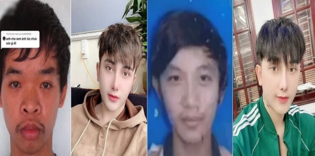 شاهدوا | دفع أكثر من 17 ألف "دولار" شاب يجري 9 عمليات تجميل