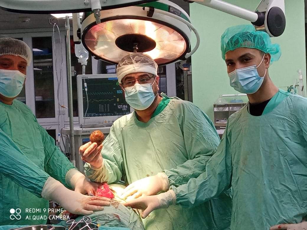 استئصال حصوة كبيرة الحجم من الكلى بمستشفى الخدمة العامة في غزّة