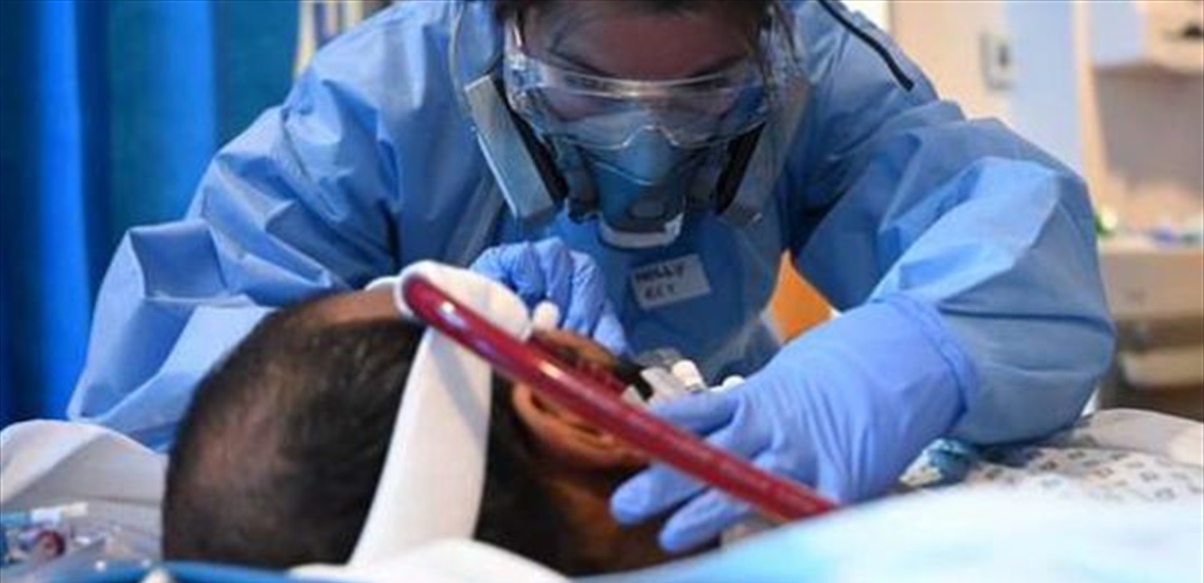 عدوى "الفطر الأسود" تغزو 3 دول عربية... تعرَّف عليها!