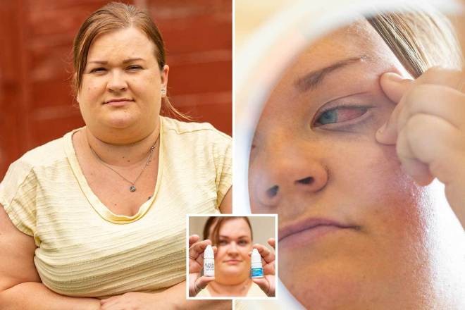 بريطانية تغلق عينها بعد وضع صمغ الأظافر بها بالخطأ