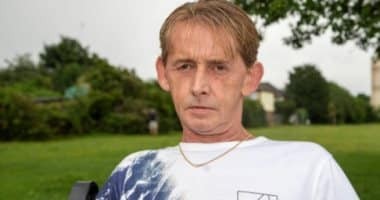 رسام بريطاني يكتشف وجود إبرة خياطة مغروسة في كبده لمدة 15 عاماً