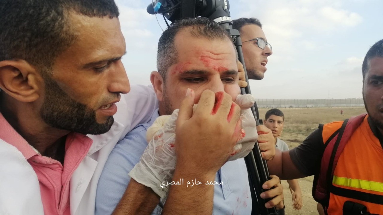 لجنة دعم الصحفيين تُعقّب على إصابة المصور عاصم شحادة شرق غزة