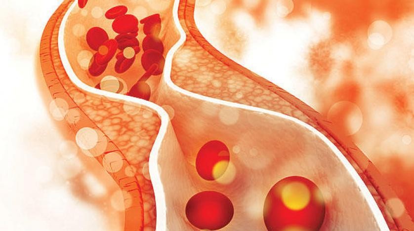 بالفيديو: خبراء يتوصلون لاكتشاف "بروتين" يحمي من "تصلب الشرايين"