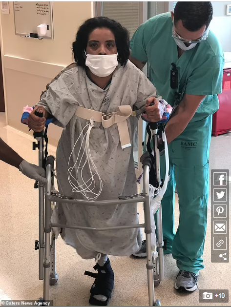 أم لطفلين تفقد ساقها بسبب لدغة عنكبوت فى تكساس