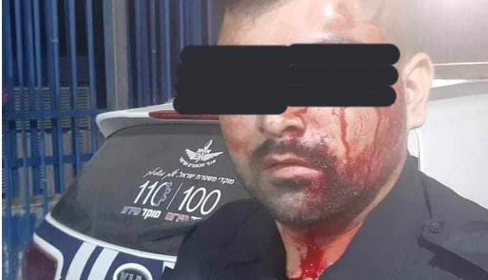 الاحتلال ينظر اليوم بتمديد اعتقال شابيْن تصديا للشرطة الإسرائيلية في كفر قاسم