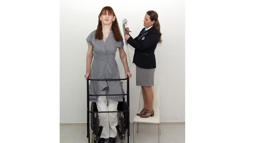 التركية روميزا أطول امرأة في العالم .. تنضم لموسوعة جينيس بـ 215.16 سم