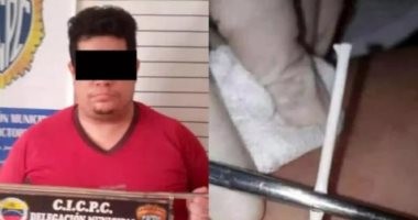 القبض على طبيب فنزويلى مزيف يزرع عصا مصاصة تحت جلد المريضات كموانع حمل