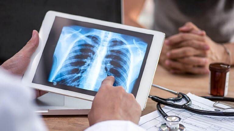 شاهد: في بريطانيا.. شاب ينفجر من الضحك