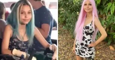 مراهقة أمريكية صارعت سمكة قرش ونجت بعد فقدان ساقها اليسرى