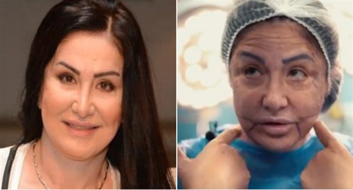 وفاء سالم تكشف تفاصيل تشوه وجهها بسبب عمليات التجميل