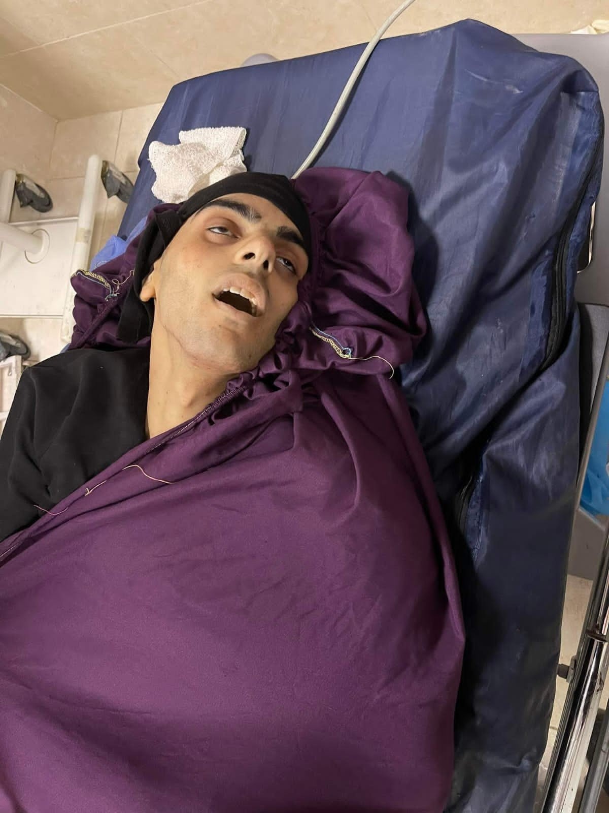 الصحة: ارتفاع حصيلة الشهداء إلى 223 شهيدًا منذ بداية العام الجاري 2022