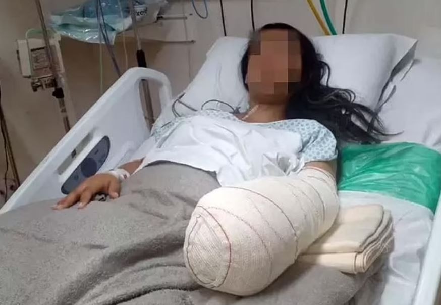 بتر يد سيدة برازيلية بعد الولادة بسبب خطأ طبى