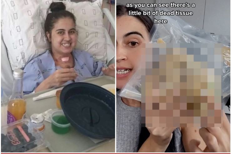 سيدة تحتفظ بقلبها الأصلى فى كيس بغرفة نومها بعد خضوعها لعملية زرع قلب