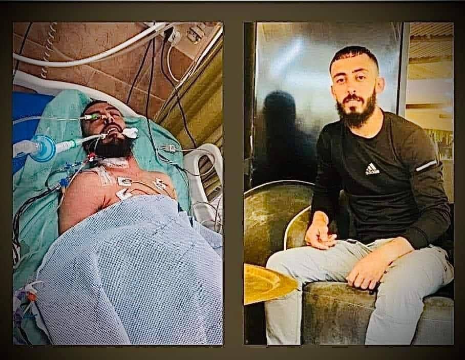 استشهاد شاب متأثراً بجراحٍ أصيب بها برصاص الاحتلال في جنين