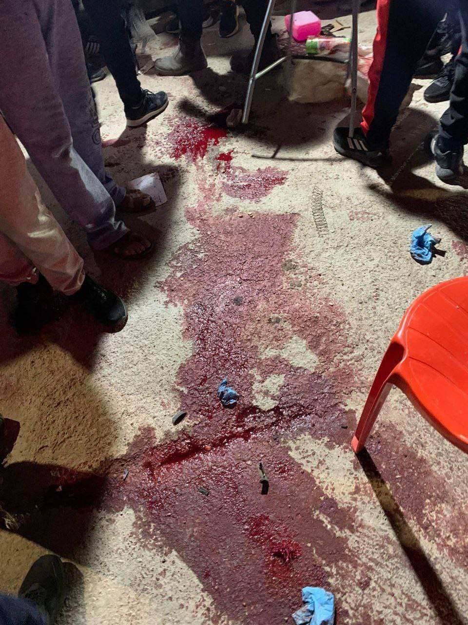 بالفيديو والصور: شهداء وإصابات برصاص الاحتلال في مخيم عقبة جبر بأريحا
