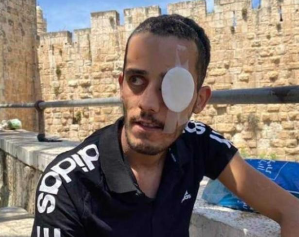 المقدسي أحمد أبو سنينة يُعاني من وضع صحي حرج إثر إصابته بالرأس والإهمال الطبي