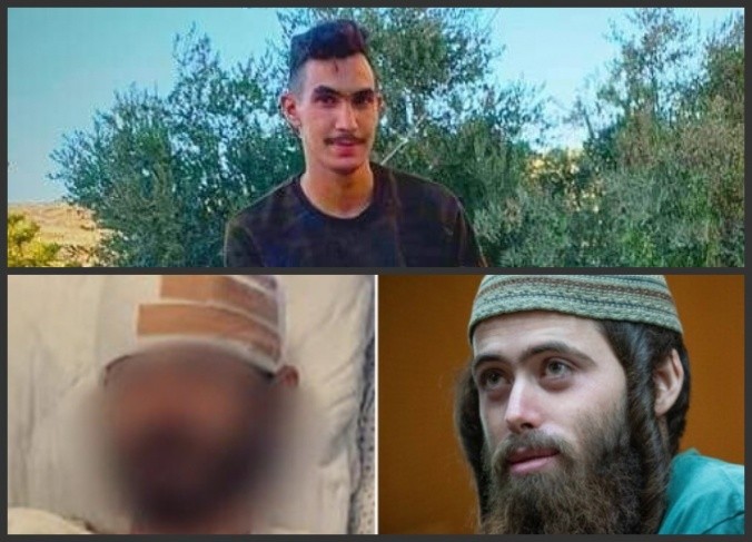 تمديد اعتقال أحد المستوطنين