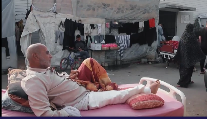 أطباء غزة يحذرون من نفاد مادة البلاتين لعلاج الكسور