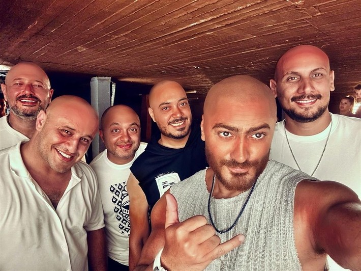 تامر حسني يتخلى عن شعره ويعلن تأسيسه رابطة لمحبي "القرع"