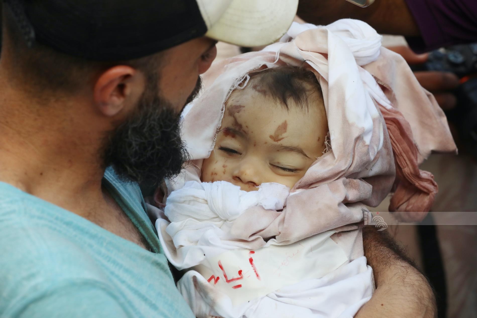 شهداء وجرحى في قصف الاحتلال المتواصل على قطاع غزة