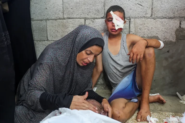 الصحة : ارتفاع حصيلة الشهداء في قطاع غزة الى 41,534 والاصابات إلى 96,092 منذ بدء العدوان