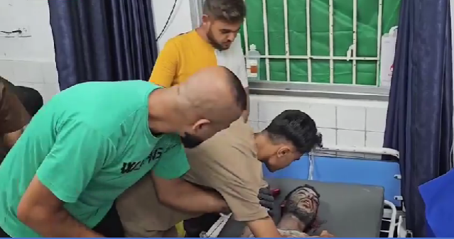 ارتفاع ضحايا العدوان الإسرائيلي إلى 41 ألفا و226 شهيدا