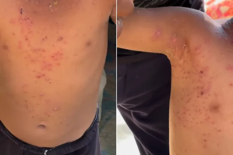 بسبب المياه الجوفية والبحر