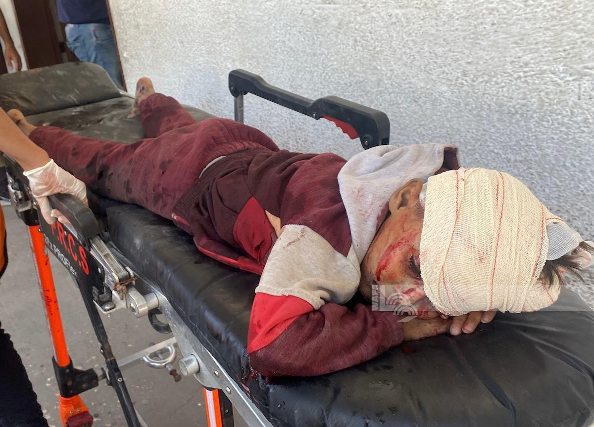 شهداء ومصابون في قصف للاحتلال على مخيمي البريج والنصيرات