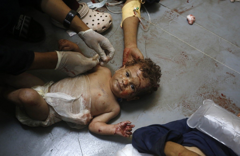 مع دخول العدوان يومه الـ421: شهداء ومصابون في قصف الاحتلال قطاع غزة