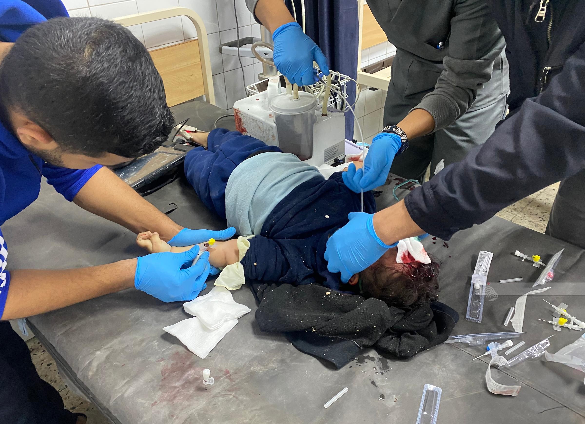 استشهاد مواطنين في قصف للاحتلال استهدف مستشفى كمال عدوان