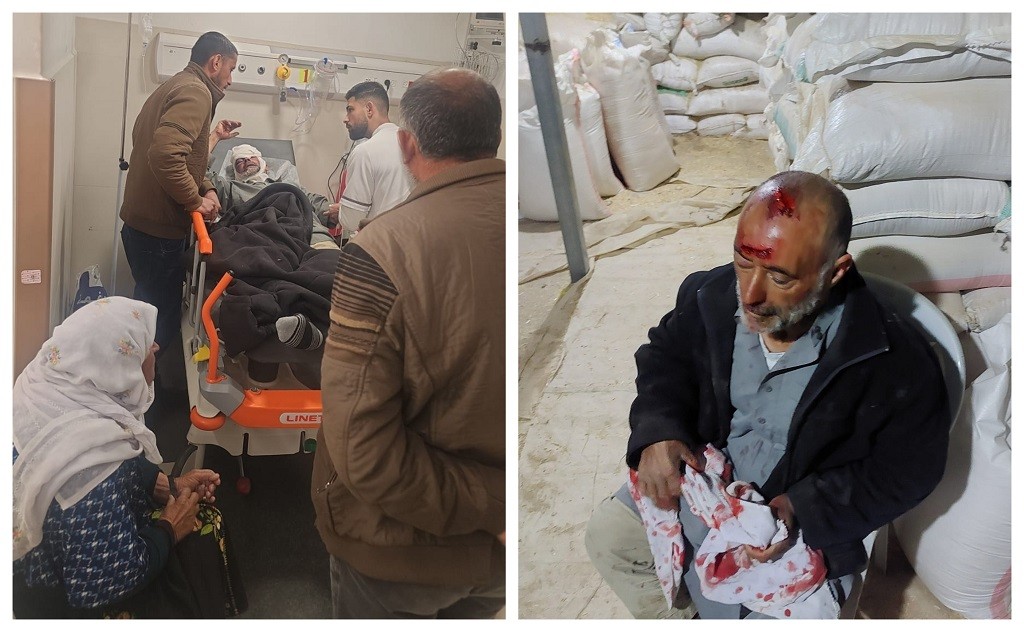 إصابة مواطن في هجوم للمستوطنين على مسافر يطا