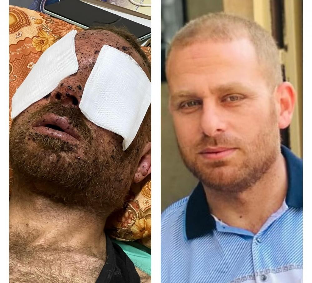 إصابة مدير هندسة المتفجرات بشمال غزة