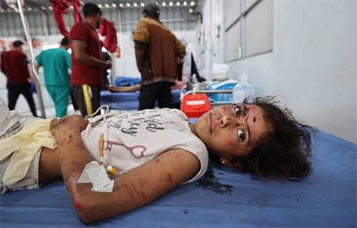 أكثر من 20 شهيدا وعشرات المصابين في قصف الاحتلال مناطق في غزة فجرا