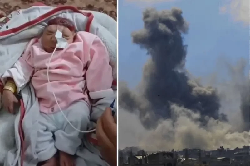 بعد ولادة طفل بدون دماغ